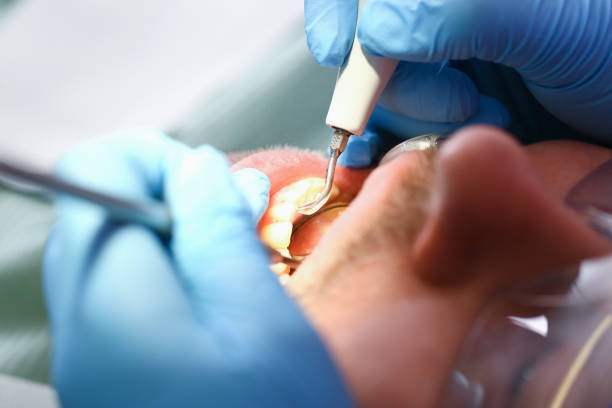 Best Emergency Gum Treatment in Nanawale Estates, HI